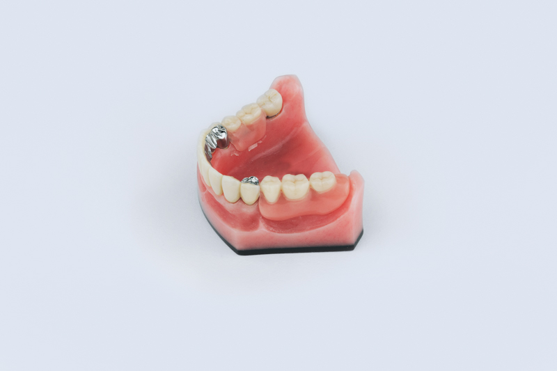 avtagbar-protetikk-dentalst-p
